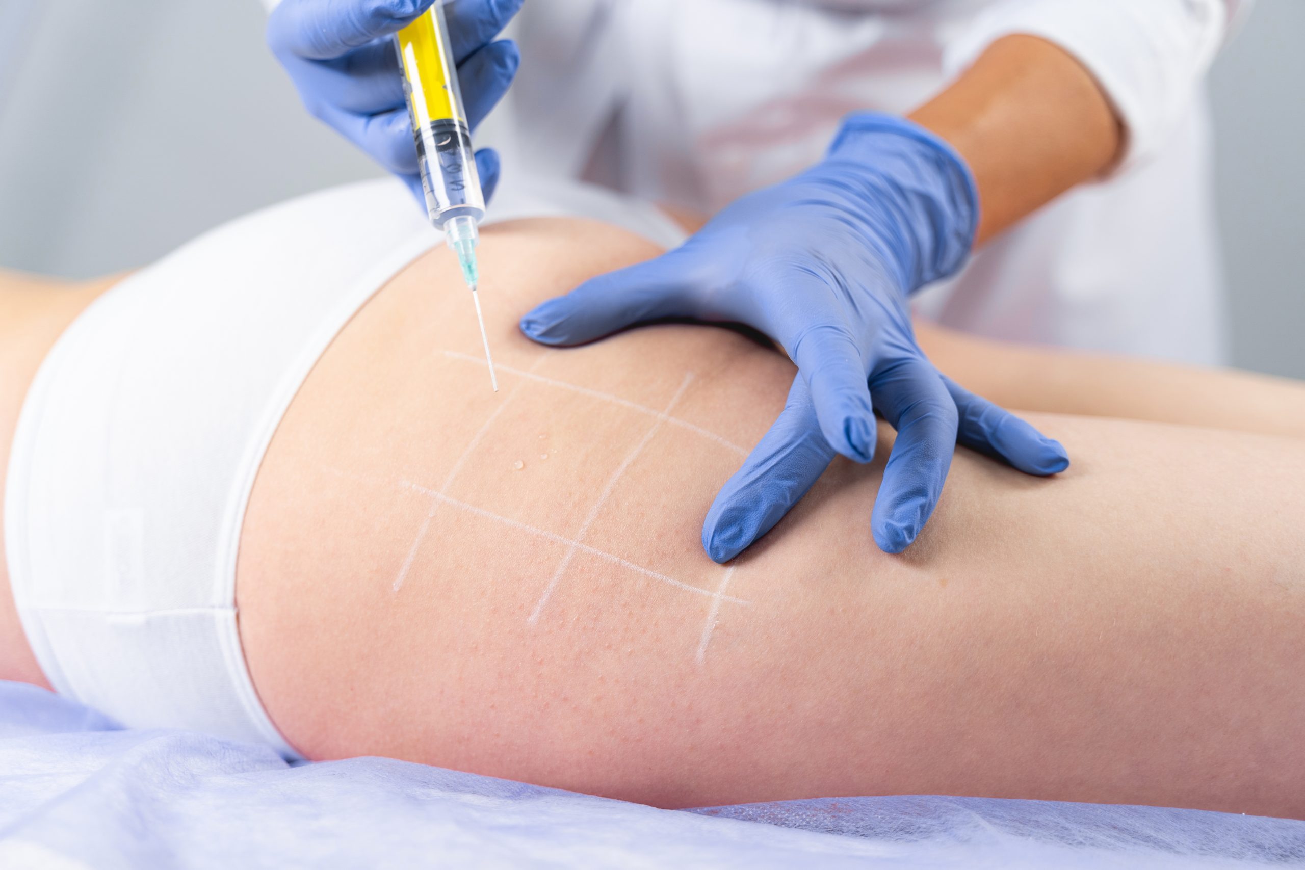 Fat-Melting-Injections-Lahore.jpg